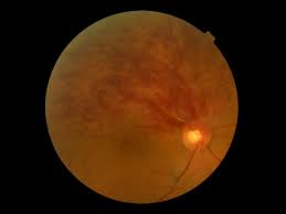 Butch With An Eye - A progress report - Image 1