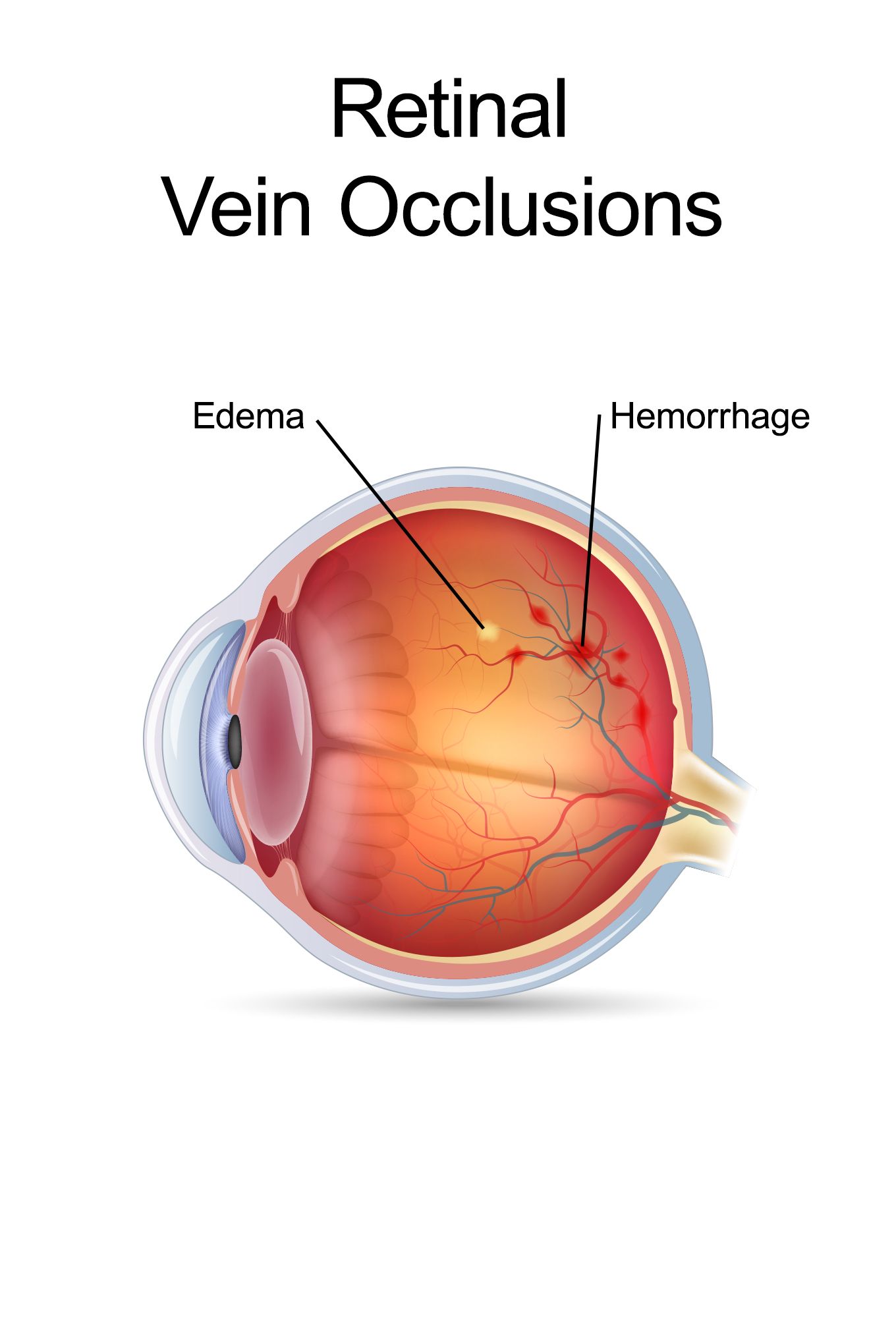 Butch With An Eye - A progress report - Image 2
