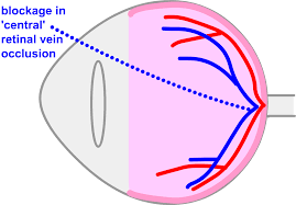 If Eyes Are Dim Eye Cannot See - Image 1