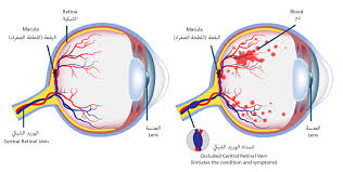 If Eyes Are Dim Eye Cannot See - Image 8
